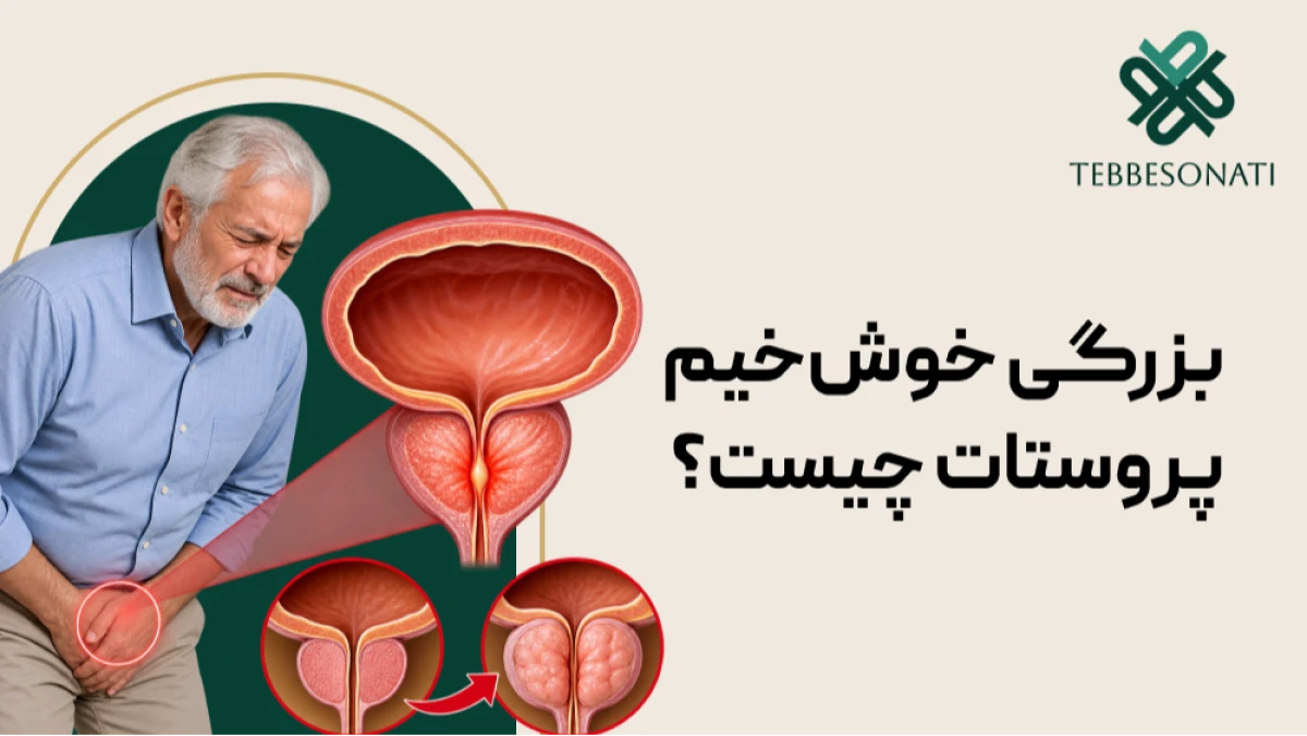 بزرگی خوش‌خیم پروستات چیست و چگونه درمان می‌شود؟