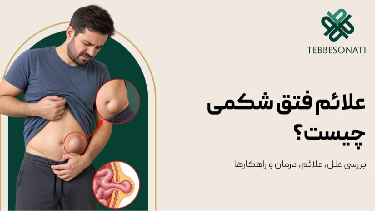 فتق شکمی چیست؟ بررسی علائم، علل و روش‌های درمان