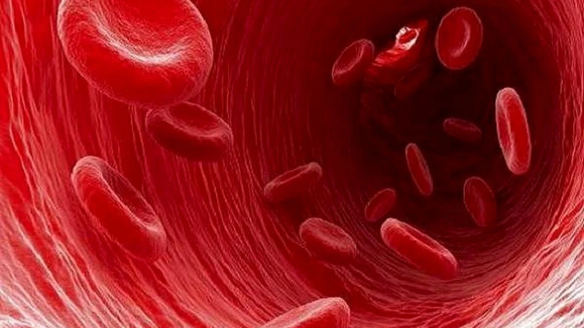 کمخونی آپلاستیک(Aplastic anemia)