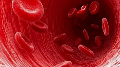 کمخونی آپلاستیک(Aplastic anemia)