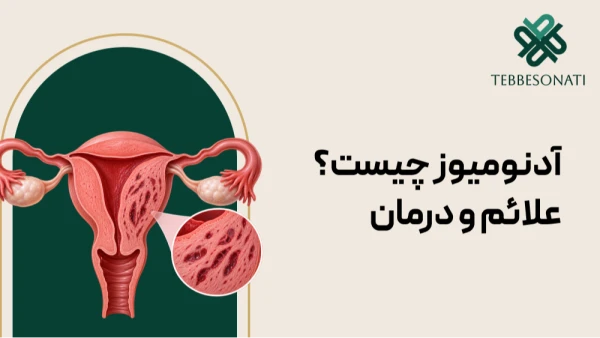 آدنومیوز رحم چیست و چگونه بر سلامت زنان تأثیر می‌گذارد؟