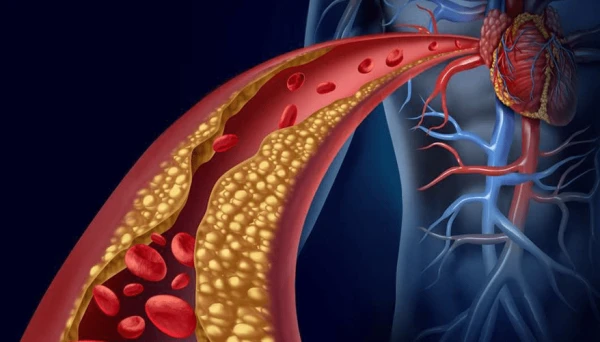 راهنمای بیماری های قلبی