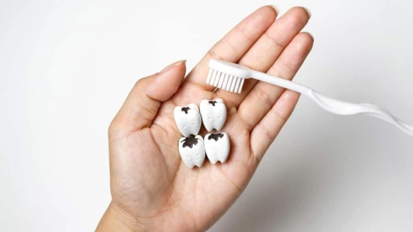 راهکارهای طبیعی موثر برای پیشگیری و درمان پوسیدگی دندان