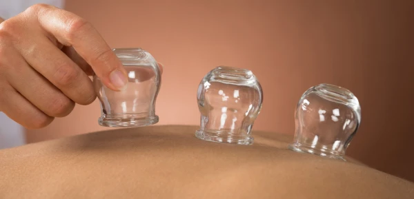 حجامت درمانی یا بادکش