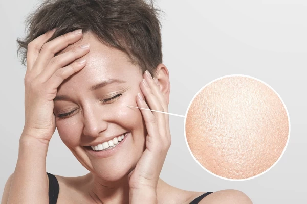 درمان‌های خانگی برای کاهش منافذ باز پوست