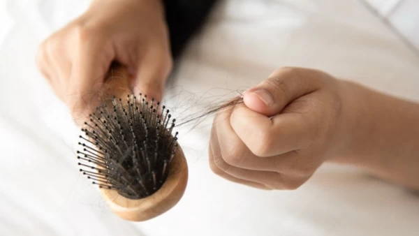 درمان ریزش موی سر