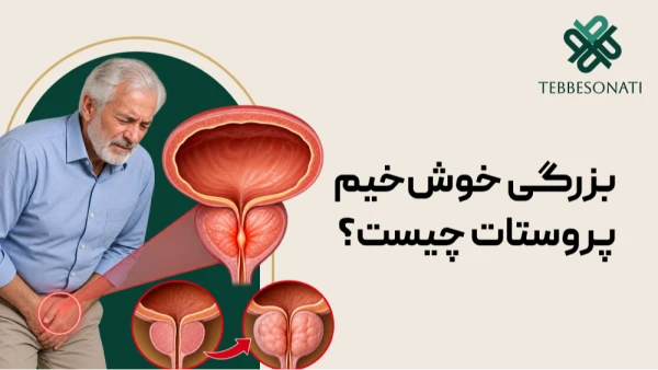 بزرگی خوش‌خیم پروستات چیست و چگونه درمان می‌شود؟